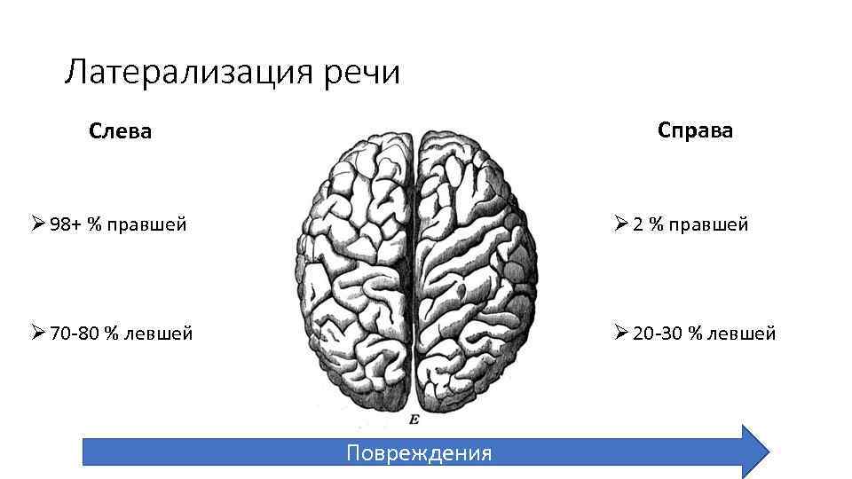 Латерализация речи Справа Слева Ø 98+ % правшей Ø 2 % правшей Ø 70