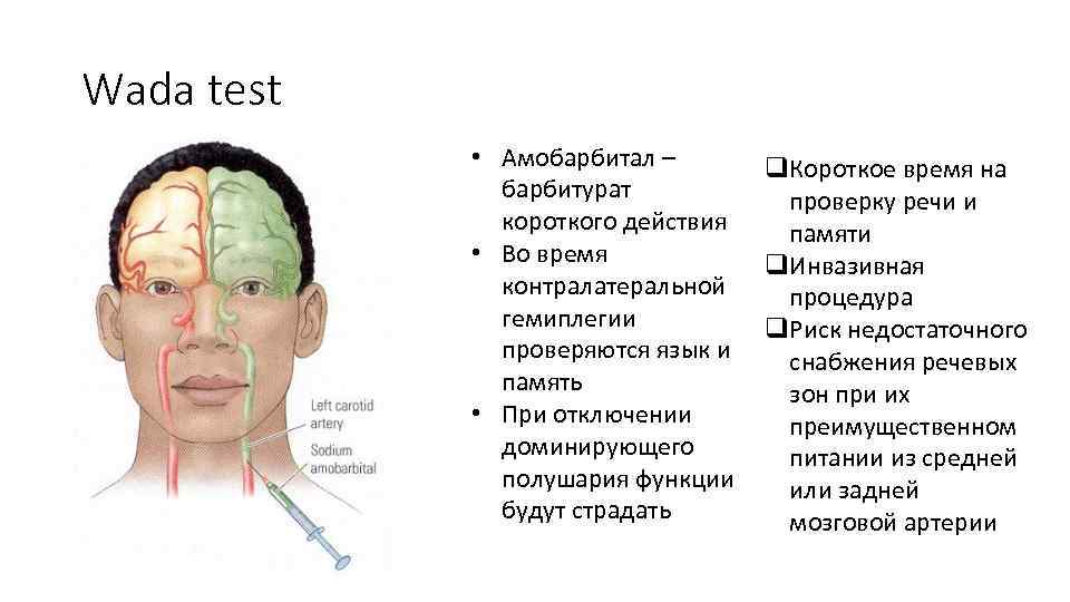 Wada test • Амобарбитал – барбитурат короткого действия • Во время контралатеральной гемиплегии проверяются