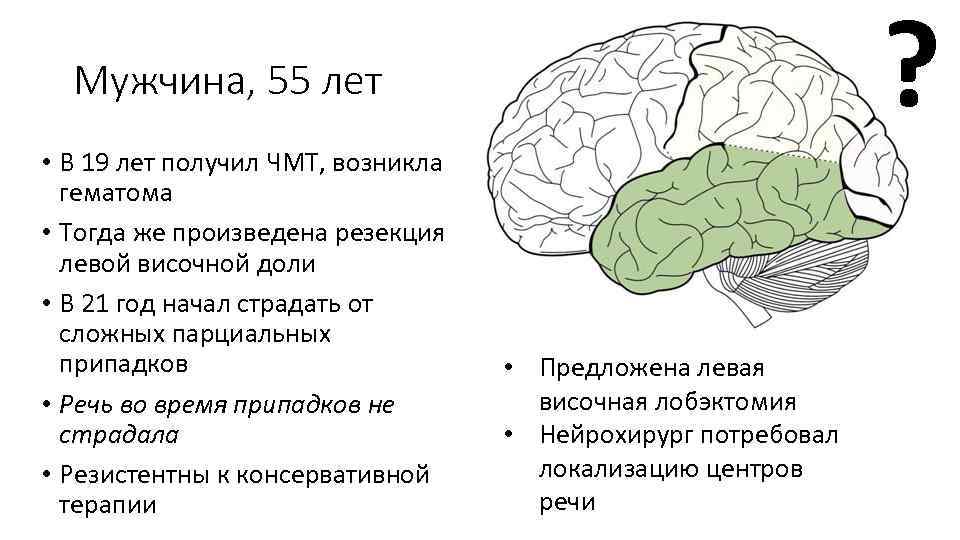 ? Мужчина, 55 лет • В 19 лет получил ЧМТ, возникла гематома • Тогда