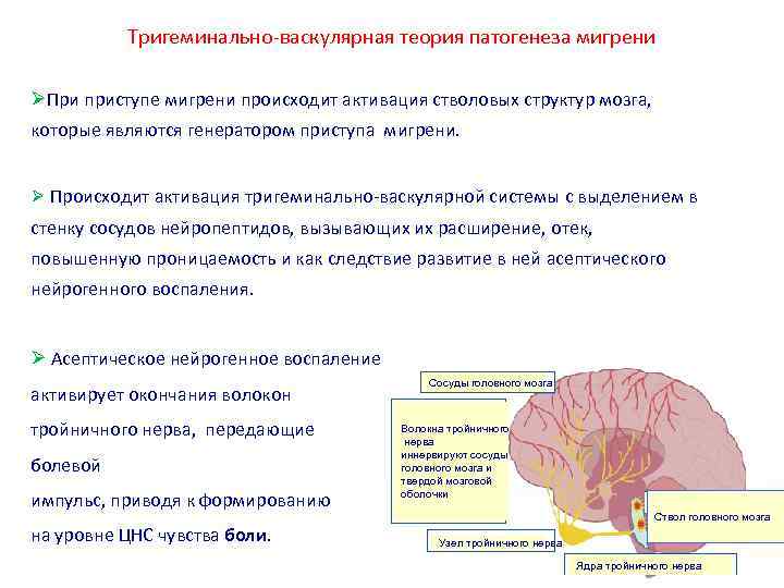 Тригеминально васкулярная теория патогенеза мигрени При приступе мигрени происходит активация стволовых структур мозга, которые
