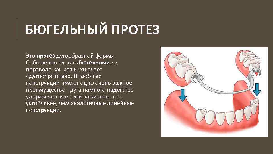 Составные элементы бюгельных протезов презентация