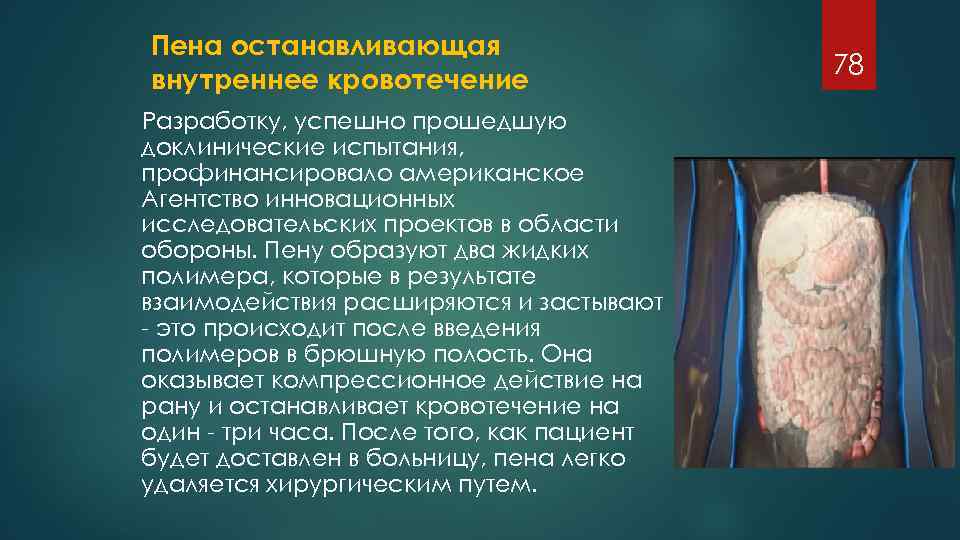 Пена останавливающая внутреннее кровотечение Разработку, успешно прошедшую доклинические испытания, профинансировало американское Агентство инновационных исследовательских