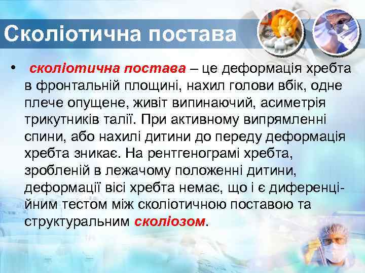 Сколіотична постава • сколіотична постава – це деформація хребта в фронтальній площині, нахил голови