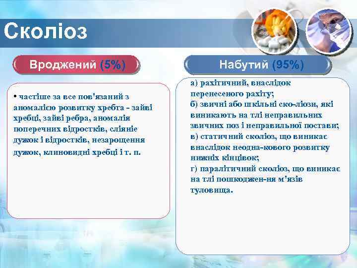 Сколіоз Вроджений (5%) • частіше за все пов'язаний з аномалією розвитку хребта - зайві