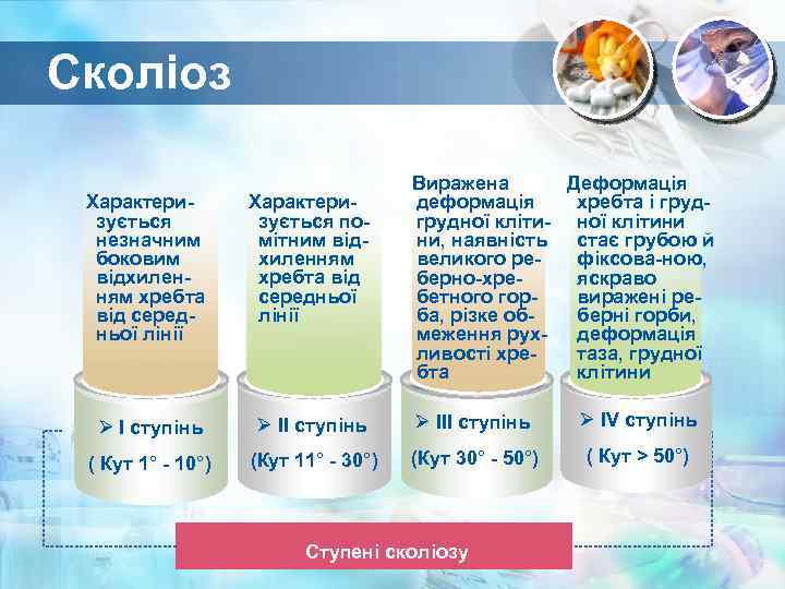 Сколіоз Виражена Деформація деформація хребта і грудної кліти- ної клітини ни, наявність стає грубою