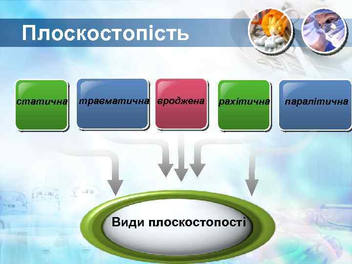 Плоскостопість статична травматична вроджена рахітична Види плоскостопості паралітична 