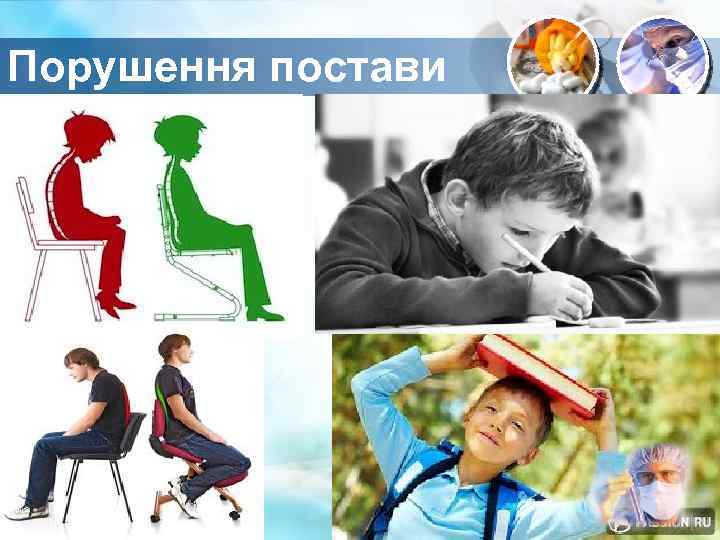 Порушення постави 