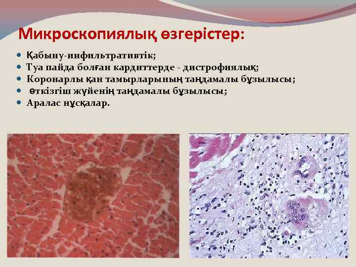 Микроскопиялық өзгерістер: Қабыну-инфильтративтік; Туа пайда болған кардиттерде - дистрофиялық; Коронарлы қан тамырларының таңдамалы бұзылысы;