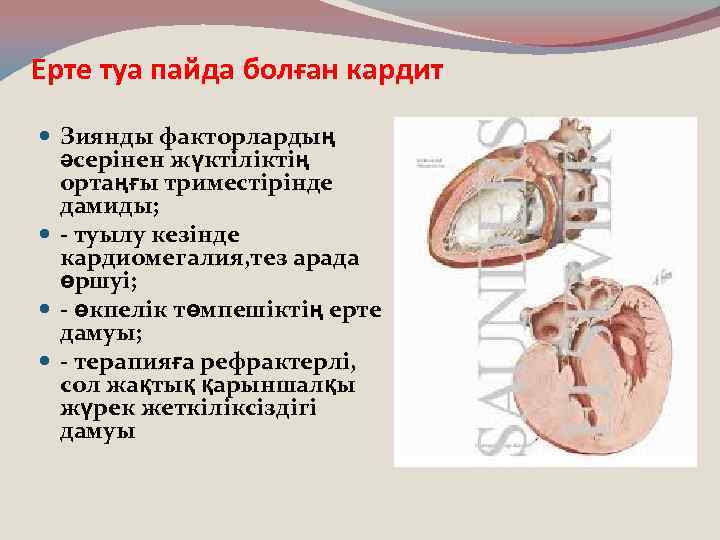 Ерте туа пайда болған кардит Зиянды факторлардың әсерінен жүктіліктің ортаңғы триместірінде дамиды; - туылу