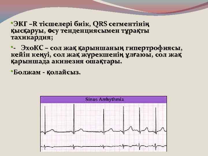  • ЭКГ –R тісшелері биік, QRS сегментінің қысқаруы, өсу тенденциясымен тұрақты тахикардия; •