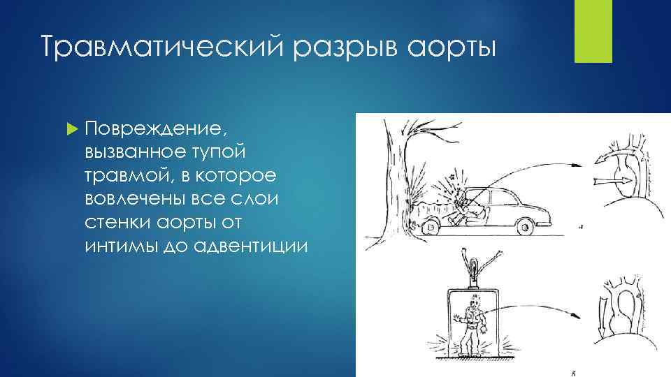 Травматический разрыв аорты Повреждение, вызванное тупой травмой, в которое вовлечены все слои стенки аорты