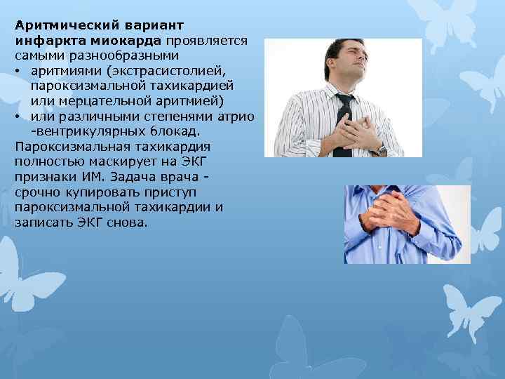 Аритмический вариант инфаркта миокарда проявляется самыми разнообразными • аритмиями (экстрасистолией, пароксизмальной тахикардией или мерцательной