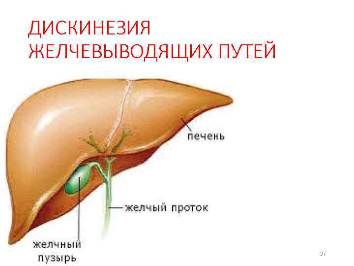 ДИСКИНЕЗИЯ ЖЕЛЧЕВЫВОДЯЩИХ ПУТЕЙ 37 