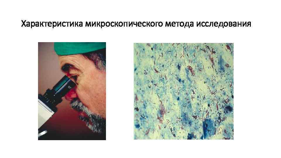 Характеристика микроскопического метода исследования 