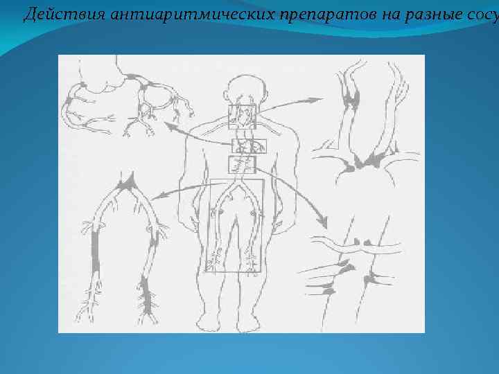 Действия антиаритмических препаратов на разные сосу 