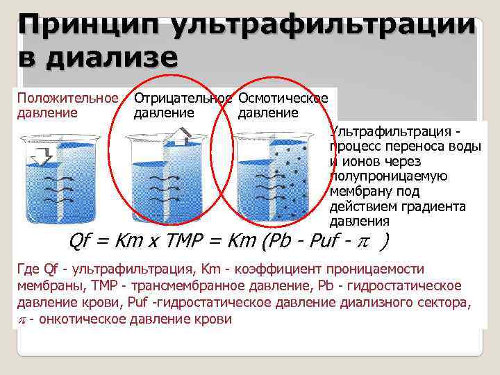 Принцип ультрафильтрации в диализе Положительное давление Отрицательное Осмотическое давление Ультрафильтрация процесс переноса воды и