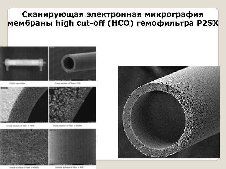 Сканирующая электронная микрография мембраны high cut-off (HCO) гемофильтра P 2 SX 
