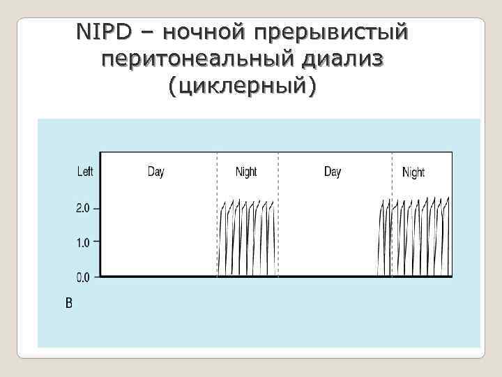 NIPD – ночной прерывистый перитонеальный диализ (циклерный) 