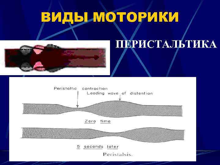 ВИДЫ МОТОРИКИ ПЕРИСТАЛЬТИКА 