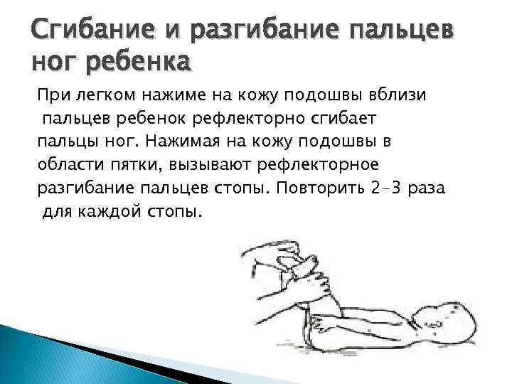 Сгибание и разгибание пальцев ног ребенка При легком нажиме на кожу подошвы вблизи пальцев