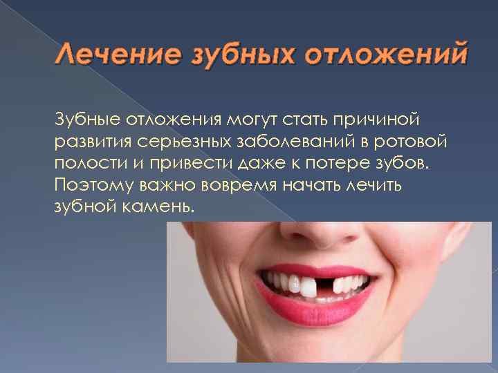 Лечение зубных отложений Зубные отложения могут стать причиной развития серьезных заболеваний в ротовой полости