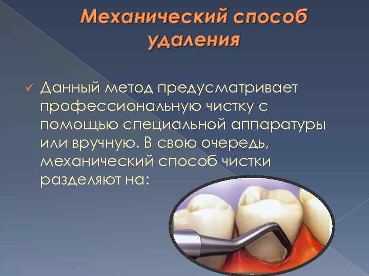 Механический способ удаления ü Данный метод предусматривает профессиональную чистку с помощью специальной аппаратуры или