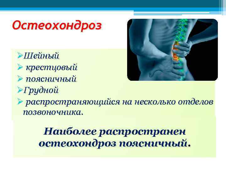 Остеохондроз ØШейный Ø крестцовый Ø поясничный ØГрудной Ø распространяющийся на несколько отделов позвоночника. Наиболее