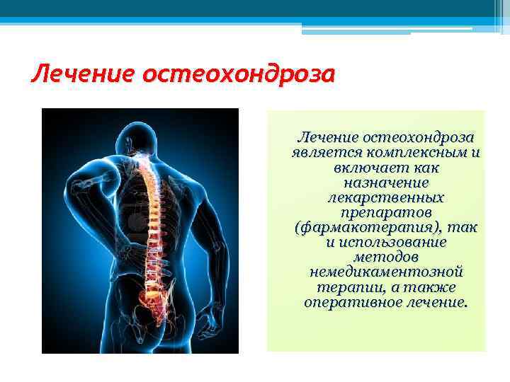 Лечение остеохондроза является комплексным и включает как назначение лекарственных препаратов (фармакотерапия), так и использование