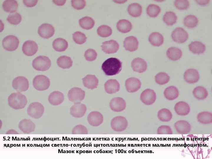5. 2 Малый лимфоцит. Маленькая клетка с круглым, расположенным в центре ядром и кольцом