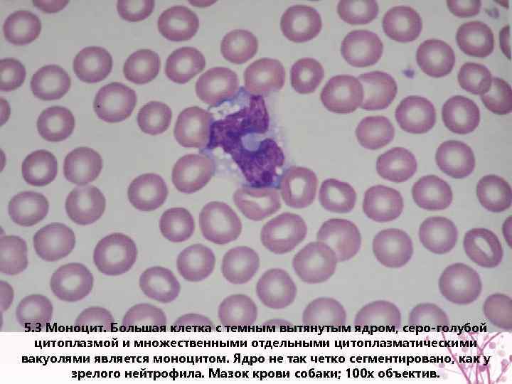 5. 3 Моноцит. Большая клетка с темным вытянутым ядром, серо-голубой цитоплазмой и множественными отдельными