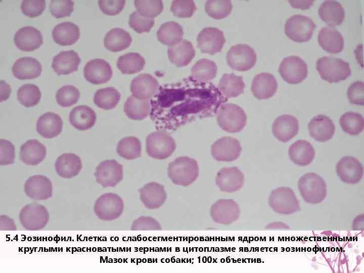5. 4 Эозинофил. Клетка со слабосегментированным ядром и множественными круглыми красноватыми зернами в цитоплазме