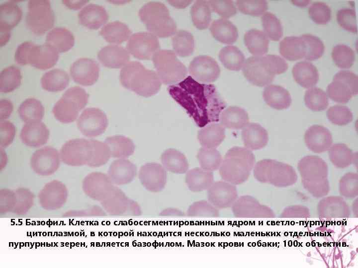 5. 5 Базофил. Клетка со слабосегментированным ядром и светло-пурпурной цитоплазмой, в которой находится несколько