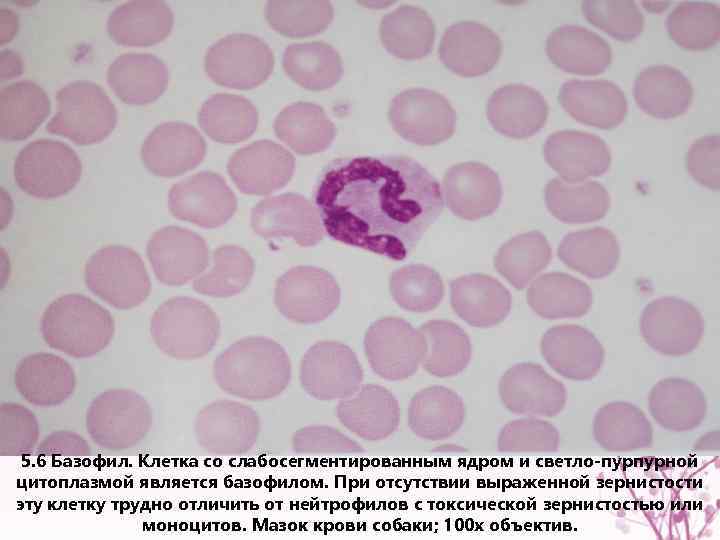 5. 6 Базофил. Клетка со слабосегментированным ядром и светло-пурпурной цитоплазмой является базофилом. При отсутствии