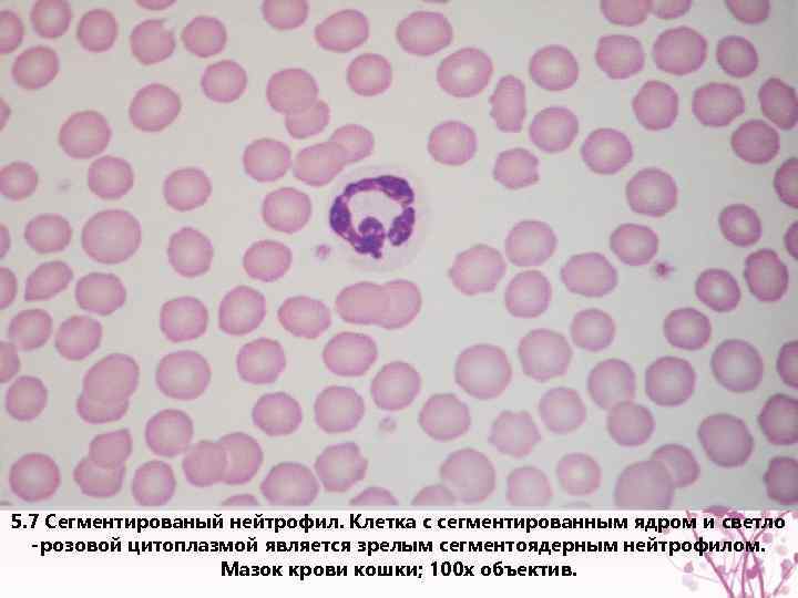 5. 7 Сегментированый нейтрофил. Клетка с сегментированным ядром и светло -розовой цитоплазмой является зрелым