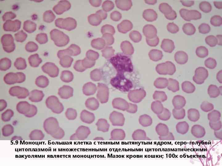 5. 9 Моноцит. Большая клетка с темным вытянутым ядром, серо-голубой цитоплазмой и множественными отдельными