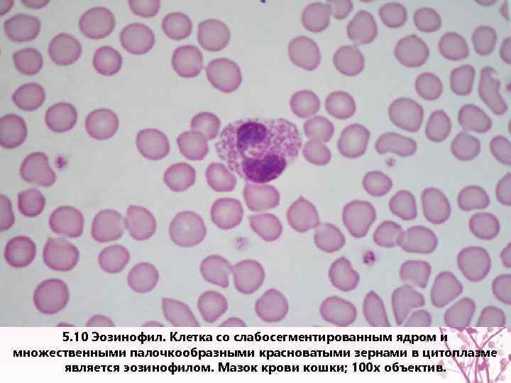 5. 10 Эозинофил. Клетка со слабосегментированным ядром и множественными палочкообразными красноватыми зернами в цитоплазме