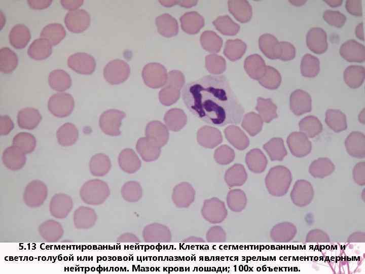 5. 13 Сегментированый нейтрофил. Клетка с сегментированным ядром и светло-голубой или розовой цитоплазмой является