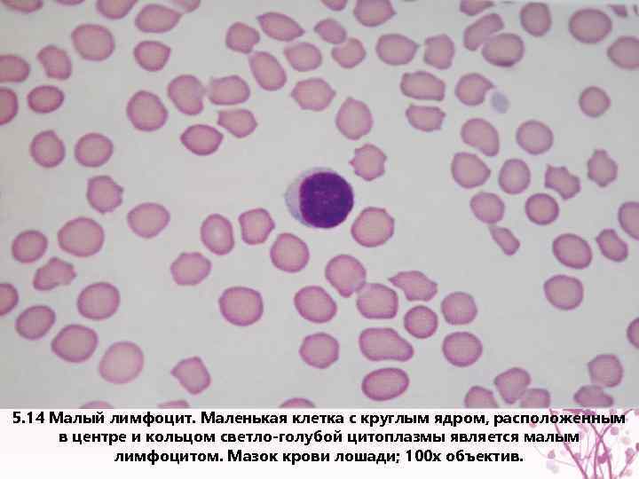 5. 14 Малый лимфоцит. Маленькая клетка с круглым ядром, расположенным в центре и кольцом