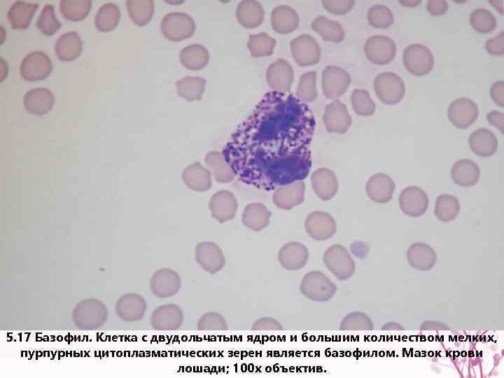 5. 17 Базофил. Клетка с двудольчатым ядром и большим количеством мелких, пурпурных цитоплазматических зерен