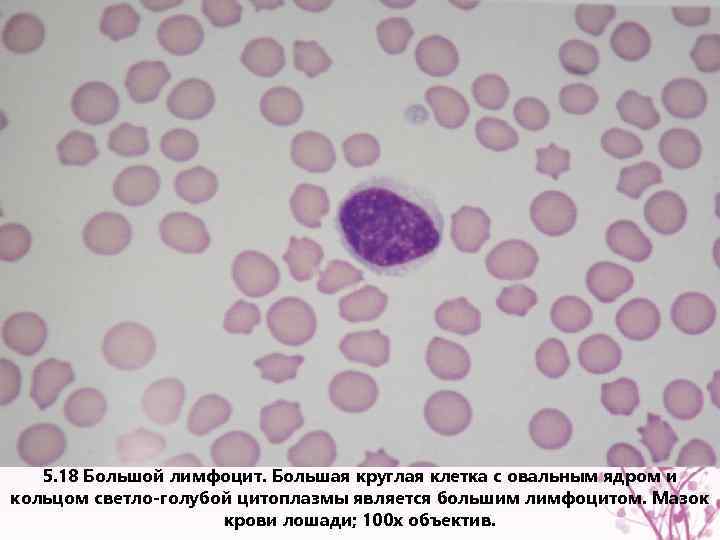 5. 18 Большой лимфоцит. Большая круглая клетка с овальным ядром и кольцом светло-голубой цитоплазмы