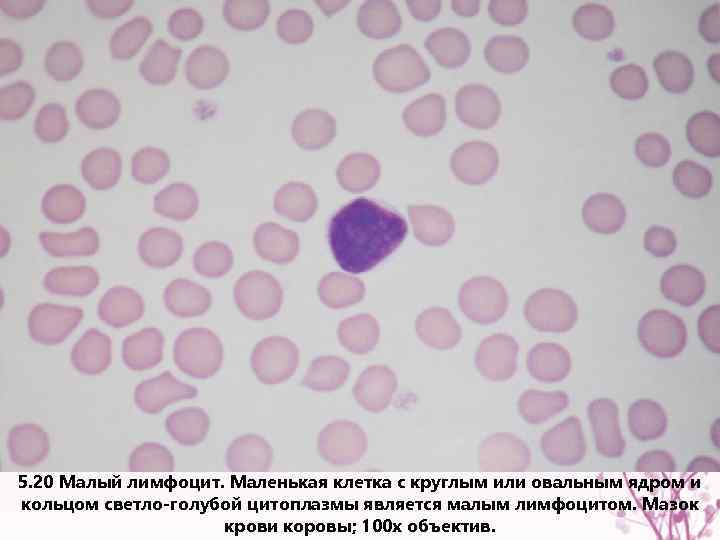 5. 20 Малый лимфоцит. Маленькая клетка с круглым или овальным ядром и кольцом светло-голубой
