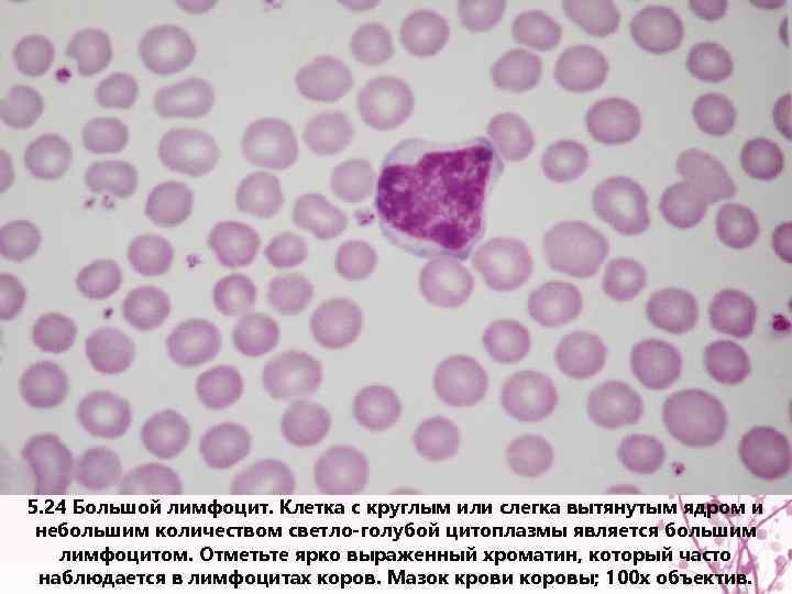 5. 24 Большой лимфоцит. Клетка с круглым или слегка вытянутым ядром и небольшим количеством