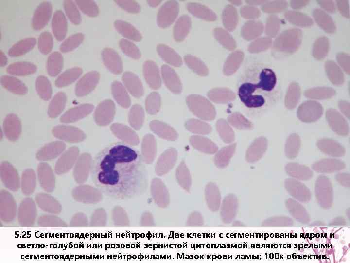 5. 25 Сегментоядерный нейтрофил. Две клетки с сегментированы ядром и светло-голубой или розовой зернистой