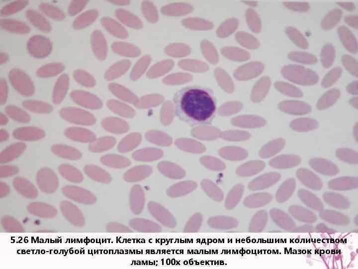 5. 26 Малый лимфоцит. Клетка с круглым ядром и небольшим количеством светло-голубой цитоплазмы является