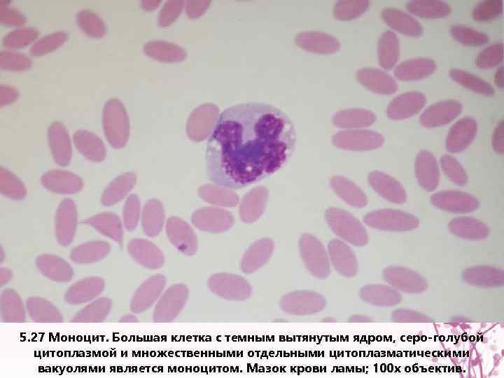 5. 27 Моноцит. Большая клетка с темным вытянутым ядром, серо-голубой цитоплазмой и множественными отдельными