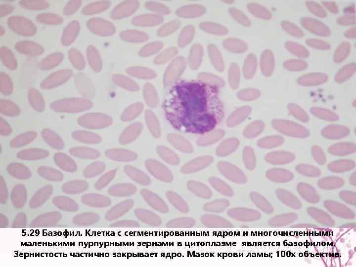5. 29 Базофил. Клетка с сегментированным ядром и многочисленными маленькими пурпурными зернами в цитоплазме