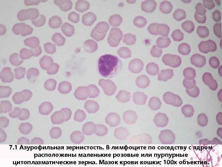 7. 1 Азурофильная зернистость. В лимфоците по соседству с ядром расположены маленькие розовые или