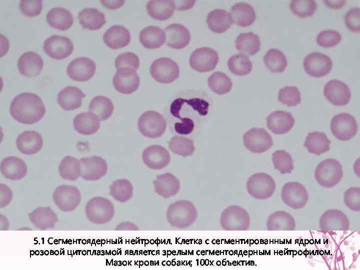 5. 1 Сегментоядерный нейтрофил. Клетка с сегментированным ядром и розовой цитоплазмой является зрелым сегментоядерным