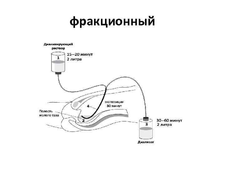 фракционный 
