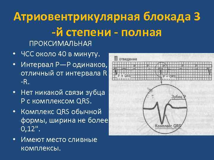 Атриовентрикулярная блокада 3 -й степени - полная • • • ПРОКСИМАЛЬНАЯ ЧСС около 40
